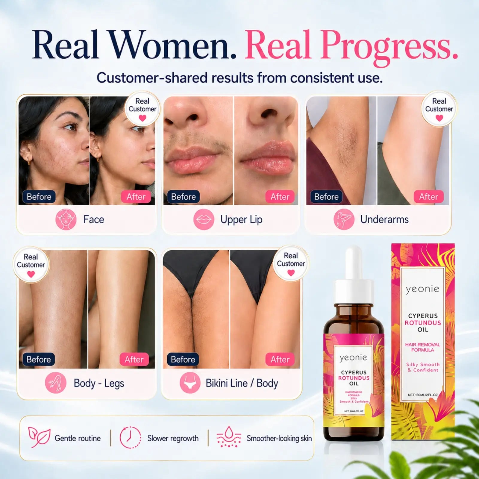 Yeonie Cyperus Rotundus Hair Reduction Serum